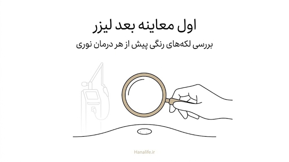 پزشک با ذرهبین یک لکه رنگی کوچک را پیش از لیزر معاینه میکند؛ اهمیت معاینه پوست پیش از لیزر