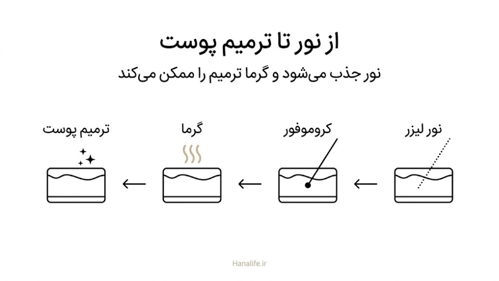 مراحل کار لیزر پوست: نور به کروموفور میرسد، گرما میسازد و ترمیم پوست آغاز میشود