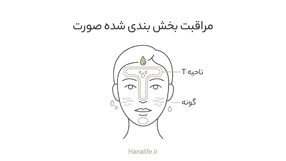 طرح صورت با ناحیه T چرب و گونه‌های کم‌آب برای مراقبت جداگانه از منافذ باز در پوست مختلط