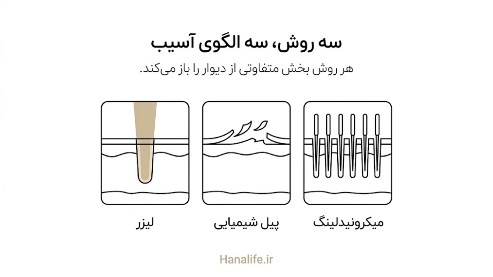  سه مقطع پوست کنار هم با لیزر، لایه‌ریزی پیل و کانال‌های میکرونیدلینگ برای مقایسه آسیب سد پوستی بعد پیل