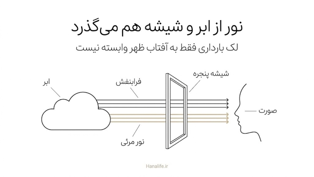  پرتوهای فرابنفش و نور مرئی که از ابر و شیشه پنجره می‌گذرند و به صورت می‌رسند؛ دلیل لک بارداری در روز ابری