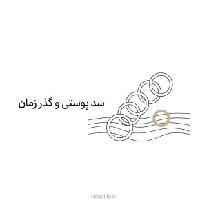 پنج حلقه خطی به‌هم‌پیوسته که یکی از آن‌ها آرام جدا می‌شود — سد پوستی و افزایش سن — هانالایف