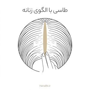 سیلوئت زنی از بالا که فرق پهنشده سرش را با دست باز میکند، موهای کنار فرق نازکترند — طاسی با الگوی زنانه — هانالایف