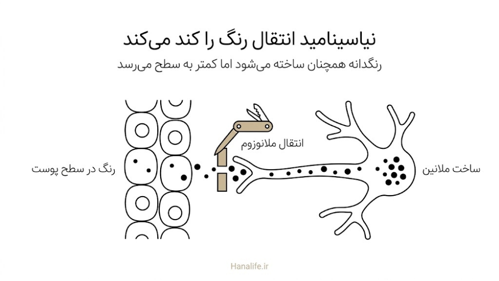 ملانوسیت ملانوزومها را به کراتینوسیت میدهد و نیاسینامید این انتقال را کند میکند؛ تصویر مفهومی درباره لک