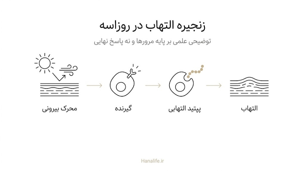چهار مرحله از محرک بیرونی تا گیرنده، پپتید التهابی و التهاب پوست؛ توضیح سازوکار علت روزاسه