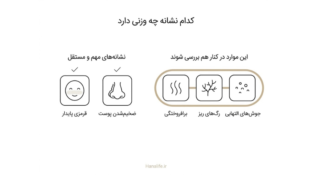 چهار نشانه روزاسه در دو گروه: دو نشانه تشخیصی و سه نشانه‌ای که فقط در کنار هم معنا دارند؛ علائم روزاسه