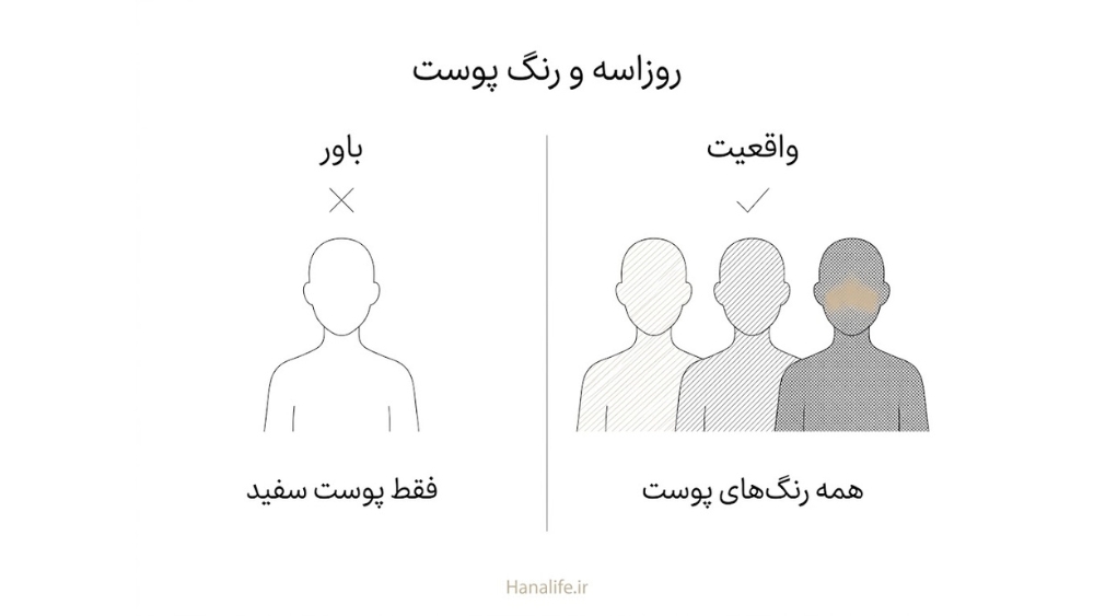  کارت دوطرفه باور و واقعیت با سیلوئت‌هایی با عمق پوست متفاوت؛ روزاسه روی پوست تیره در ایران