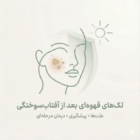 تصویر کاور مقاله درباره لک‌های قهوه‌ای بعد از آفتاب‌سوختگی با نماد آفتاب و محافظت پوستی.